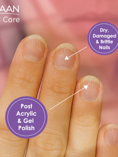 Shaan Nail Care 4 ml