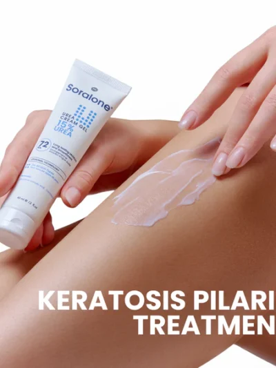 SORALONE UREA 15% CREAM GEL 60ML